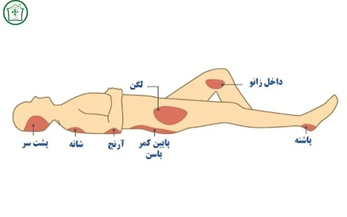 چگونه زخم بستر را تشخیص دهیم؟