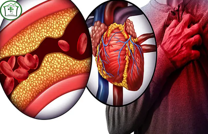 روش‌های تشخیص سکته قلبی