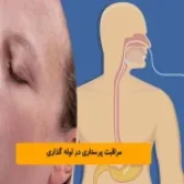 مراقبت پرستاری در لوله گذاری