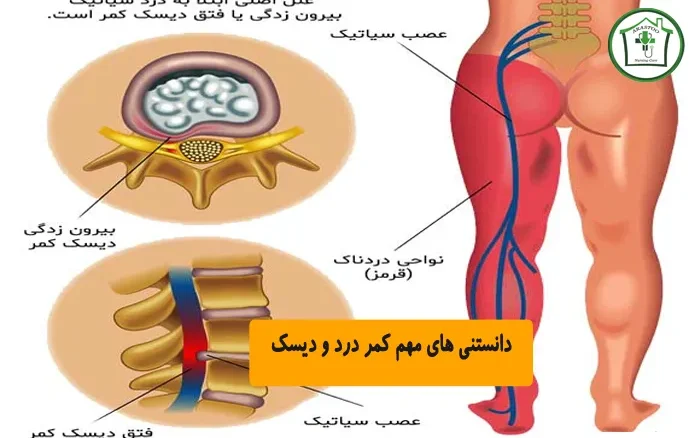 دانستني هاي مهم دیسک کمر و کمر درد