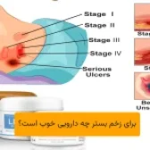 برای زخم بستر چه دارویی خوب است؟